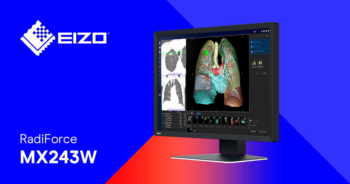 RadiForce MX243W | 24" monitor DICOM PreSet s rozlišením 2,3 MP