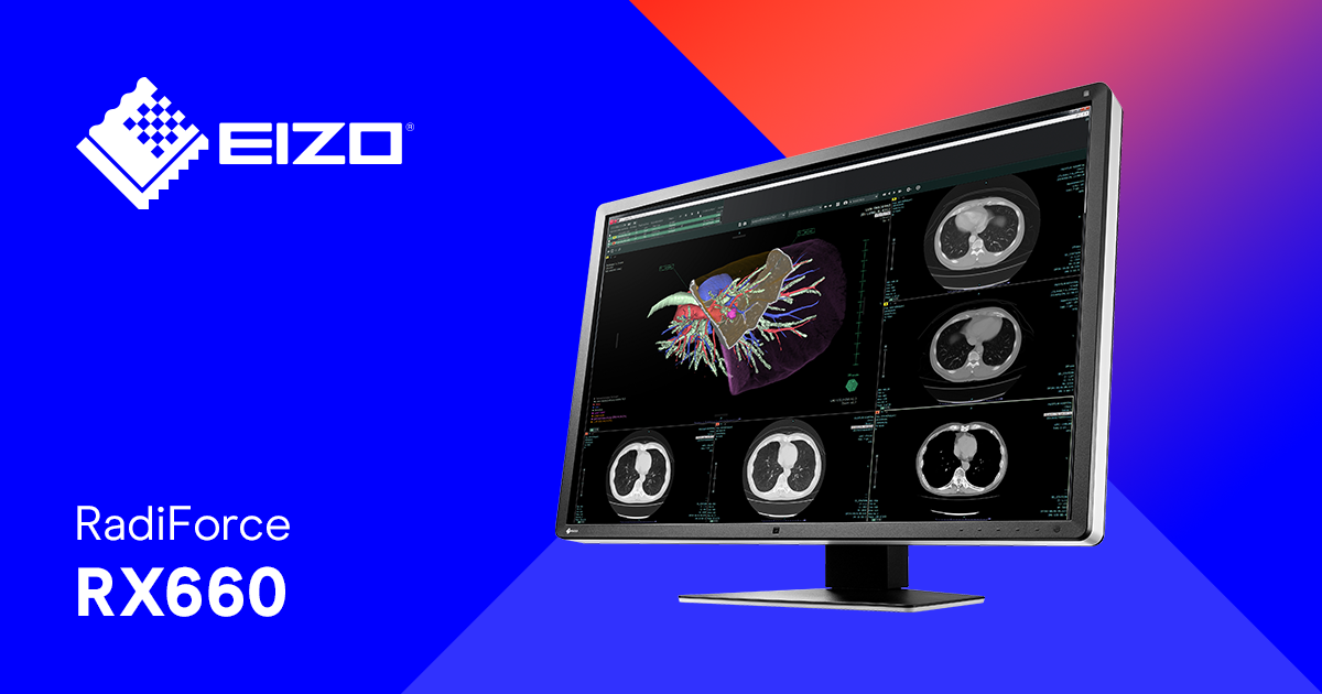 RadiForce RX660 | 6 MP diagnostický monitor (barevný)